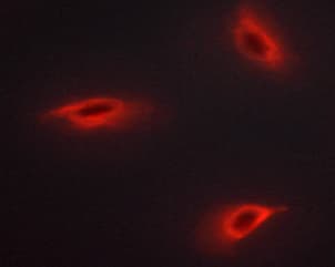 IRS1 Antibody (phospho-Ser312)