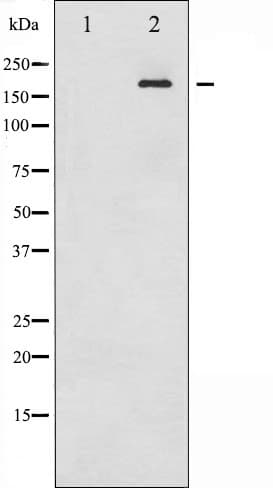IRS1 Antibody (phospho-Ser312)