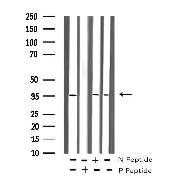 Polyclonal Rabbit anti-Human IRS1 Antibody (phospho-Ser636, IHC, IF, WB)
