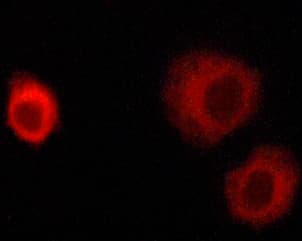 Polyclonal Rabbit anti-Human IRS1 Antibody (phospho-Ser636, IHC, IF, WB)