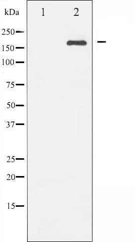 Polyclonal Rabbit anti-Human IRS1 Antibody (phospho-Ser636, IHC, IF, WB)