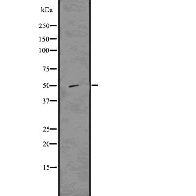 Polyclonal Rabbit anti-Human TXNIP Antibody (IHC, WB)