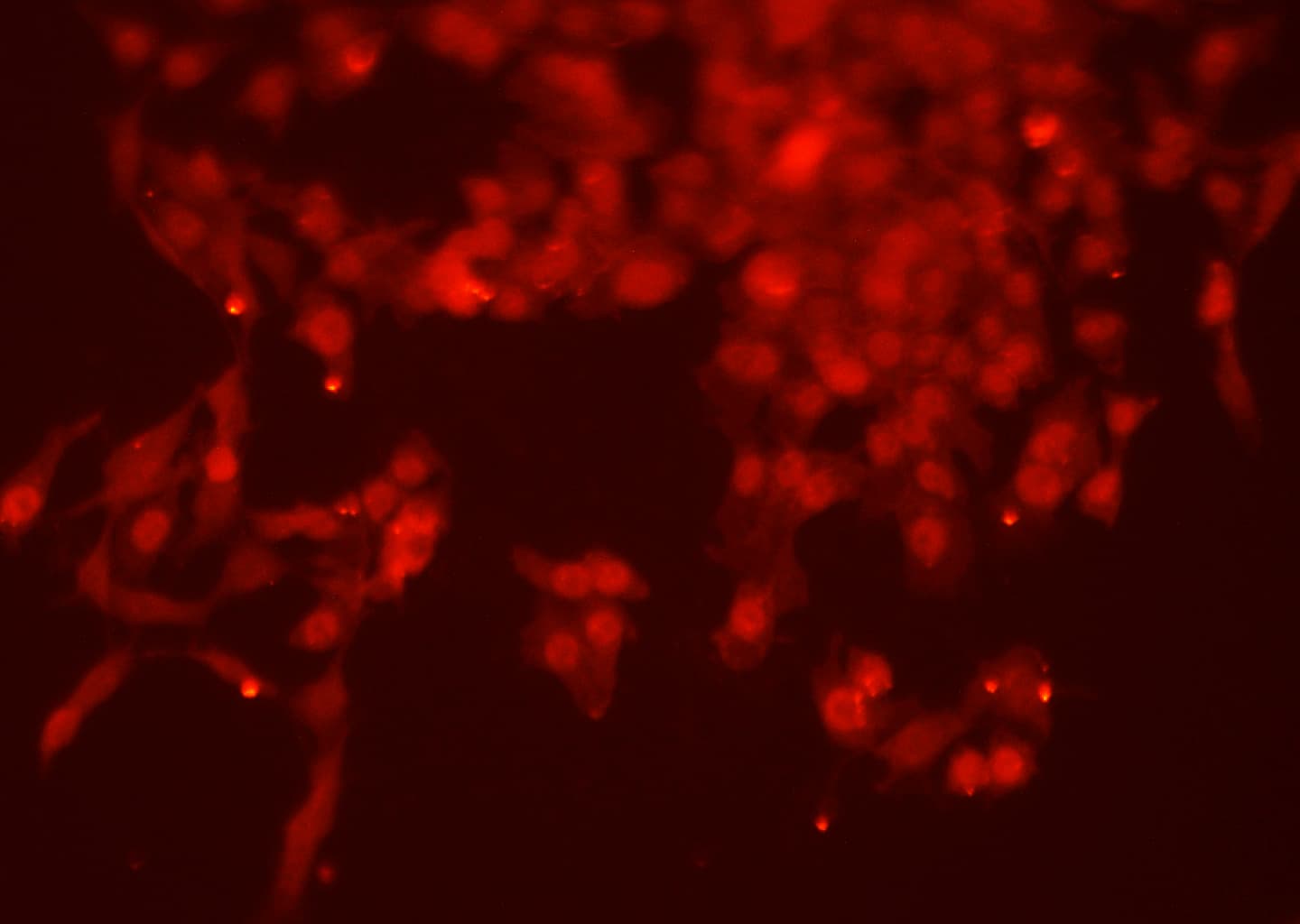 Polyclonal Rabbit anti-Human NUMB Antibody (IF, WB)