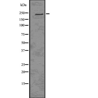 Polyclonal Rabbit anti-Human EIF4G1 / EIF4G Antibody (WB)