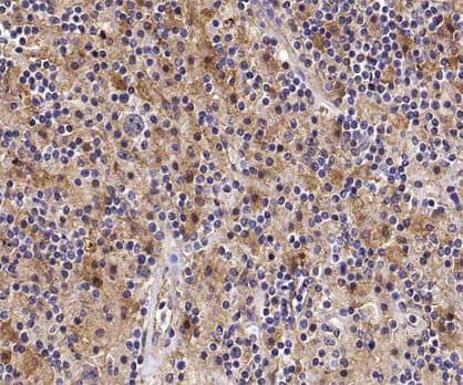 Polyclonal Rabbit anti-Human STK4 Antibody (IHC, WB)
