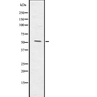 Polyclonal Rabbit anti-Human ERG Antibody (IHC, IF, WB)