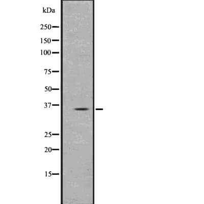Polyclonal Rabbit anti-Human PPT1 / CLN1 Antibody (IF, WB)