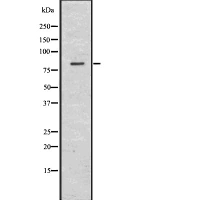 Polyclonal Rabbit anti-Human CHAT Antibody (WB)