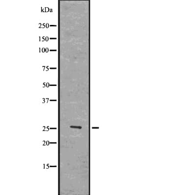 Polyclonal Rabbit anti-Human SOD3 Antibody (IF, WB)