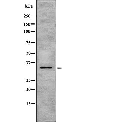 Polyclonal Rabbit anti-Human HSD17 / HSD17B1 Antibody (IF, WB)