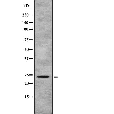 Polyclonal Rabbit anti-Human AICDA / AID Antibody (WB)