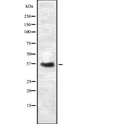 Polyclonal Rabbit anti-Human CD66c / CEACAM6 Antibody (WB)