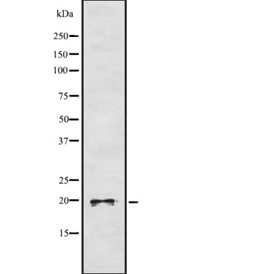 Polyclonal Rabbit anti-Human DUSP3 / VHR Antibody (IHC, WB)