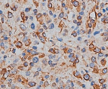 Polyclonal Rabbit anti-Human CD82 Antibody (IHC, WB)