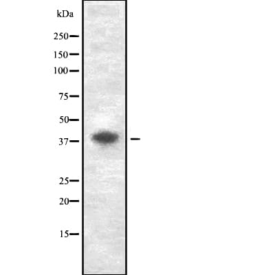 Polyclonal Rabbit anti-Human GDF3 Antibody (WB)