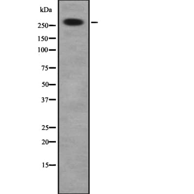 Polyclonal Rabbit anti-Human DSP / Desmoplakin Antibody (WB)