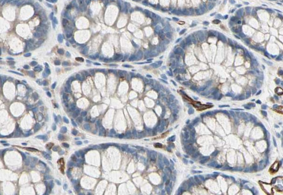 Polyclonal Rabbit anti-Human C1qRP / CD93 Antibody (WB)