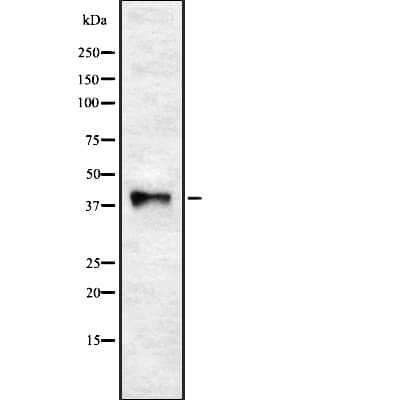Polyclonal Rabbit anti-Human WNT5B Antibody (WB)