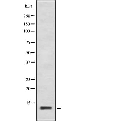 Polyclonal Rabbit anti-Human CALCA Antibody (IHC, IF, WB)