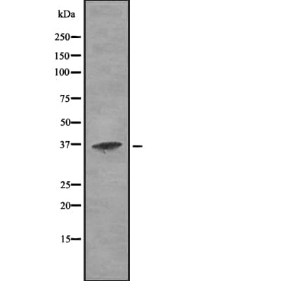 Polyclonal Rabbit anti-Human CTSH / Cathepsin H Antibody (IHC, IF, WB)