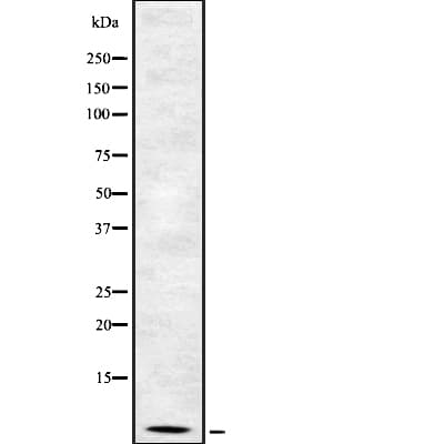 Polyclonal Rabbit anti-Human DEFB4A / BD-2 Antibody (IF, WB)