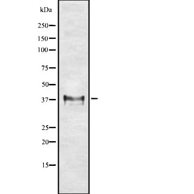 Polyclonal Rabbit anti-Human HLA-G Antibody (WB)