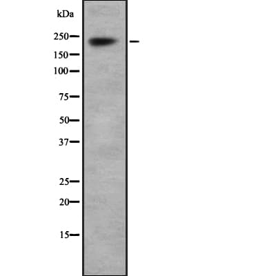 Polyclonal Rabbit anti-Human SCN1A / Nav1.1 Antibody (WB)