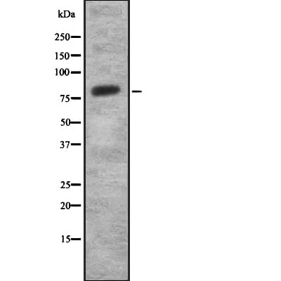 Polyclonal Rabbit anti-Human SEMA3C / Semaphorin 3C Antibody (IHC, WB)