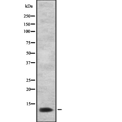 Polyclonal Rabbit anti-Human PSCA Antibody (IF, WB)