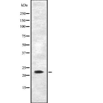 Polyclonal Rabbit anti-Human AK5 / Adenylate Kinase 5 Antibody (IF, WB)