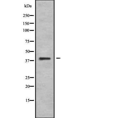 Polyclonal Rabbit anti-Human WNT10B Antibody (IF, WB)