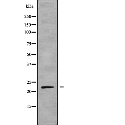 Polyclonal Rabbit anti-Human NKIRAS1 Antibody (IHC, WB)