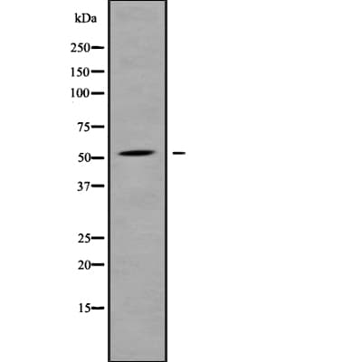 Polyclonal Rabbit anti-Human ALS2CR12 Antibody (WB)