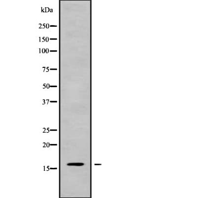 Polyclonal Rabbit anti-Human CALML5 Antibody (IHC, WB)