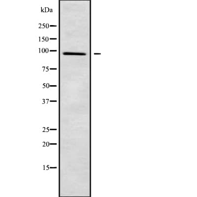 PLA2G4F Antibody