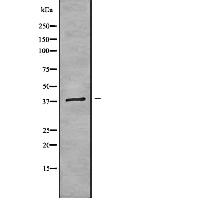 MT-ND2 Antibody