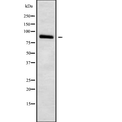 Polyclonal Rabbit anti-Human HCN3 Antibody (IF, WB)