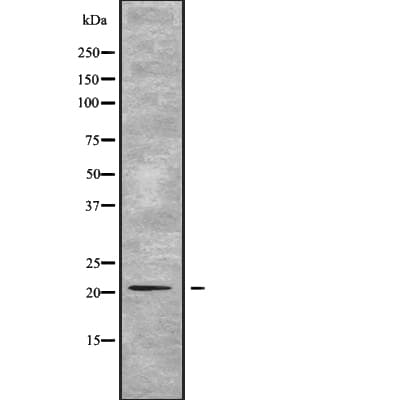 Polyclonal Rabbit anti-Human CD164 Antibody (IHC, WB)