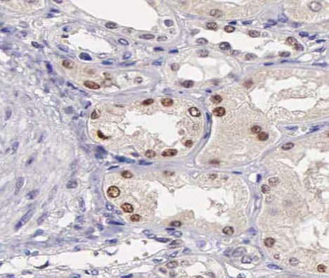 Polyclonal Rabbit anti-Human ATF2 Antibody (phospho-Ser62,phospho-Ser44, IHC, IF, WB)