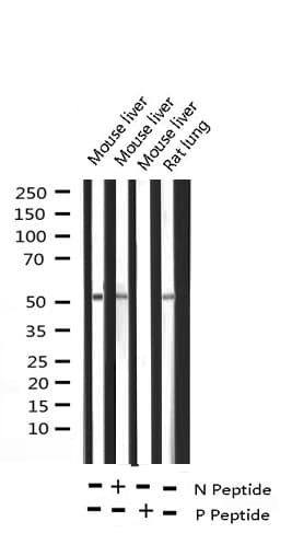 ATF2 Antibody (phospho-Thr71,pThr53)