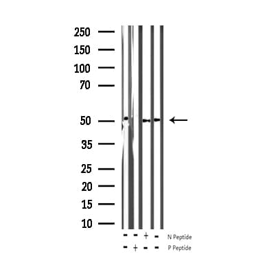 ATF2 Antibody (phospho-Thr73,pThr55)