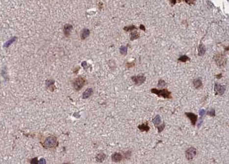 ATF2 Antibody (phospho-Thr73,pThr55)