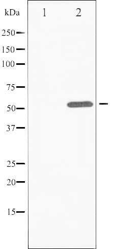 ATF2 Antibody (phospho-Thr73,pThr55)