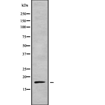 Polyclonal Rabbit anti-Human MLC2 / MYL9 Antibody (IF, WB)