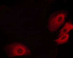 PECAM-1 / CD31 Antibody (phospho-Tyr713)