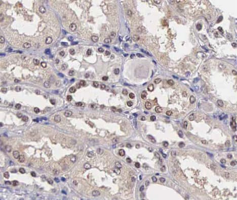 Polyclonal Rabbit anti-Human STMN1 / Stathmin / LAG Antibody (phospho-Ser24, IHC, IF, WB)