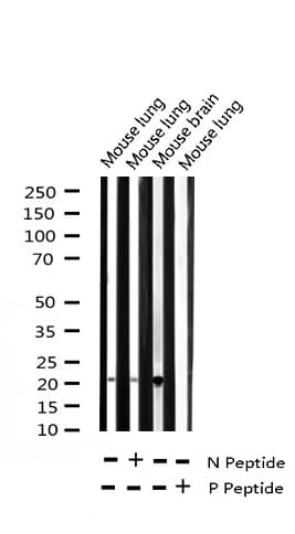 Polyclonal Rabbit anti-Human STMN1 / Stathmin / LAG Antibody (phospho-Ser37, IHC, IF, WB)