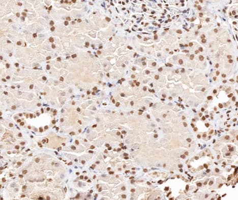 Polyclonal Rabbit anti-Human STMN1 / Stathmin / LAG Antibody (phospho-Ser37, IHC, IF, WB)
