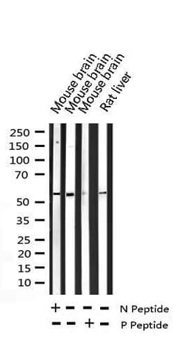 Polyclonal Rabbit anti-Human GABRB1 Antibody (phospho-Ser434, IHC, IF, WB)