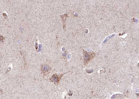 Polyclonal Rabbit anti-Human GABRB1 Antibody (phospho-Ser434, IHC, IF, WB)